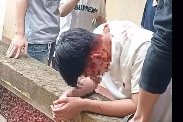 Hình ảnh nam sinh bị đánh thương tích.
