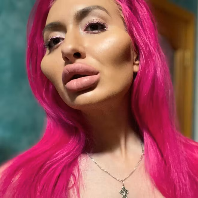 Anastasia được dân mạng gọi với biệt danh cô gái có cặp má lớn nhất thế giới.