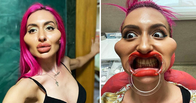 Cô gái với cặp má lớn nhất thế giới từng gây tranh cãi trên MXH khiến dân tình tiếc hùi hụi khi lộ ảnh chân dung trước đây - Ảnh 2.