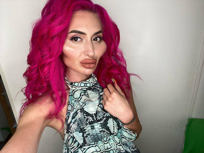 Cô gái với cặp má lớn nhất thế giới từng gây tranh cãi trên MXH khiến dân tình tiếc hùi hụi khi lộ ảnh chân dung trước đây - Ảnh 3. Cô gái với cặp má lớn nhất thế giới từng gây tranh cãi trên MXH khiến dân tình tiếc hùi hụi khi lộ ảnh chân dung trước đây - Ảnh 3.