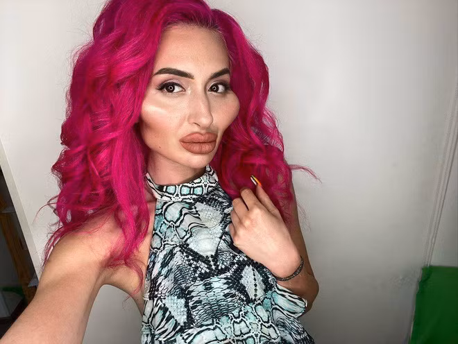 Cô gái với cặp má lớn nhất thế giới từng gây tranh cãi trên MXH khiến dân tình tiếc hùi hụi khi lộ ảnh chân dung trước đây - Ảnh 3. Cô gái với cặp má lớn nhất thế giới từng gây tranh cãi trên MXH khiến dân tình tiếc hùi hụi khi lộ ảnh chân dung trước đây - Ảnh 3.