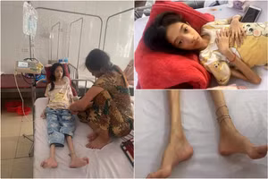 Khánh Huyền đang điều trị tại Bệnh viện Đa khoa Hà Tĩnh với thân hình da bọc xương.