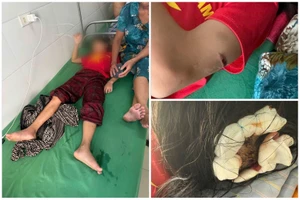 Học sinh lớp 5 đang điều trị tại bệnh viện với nhiều vết thương trên cơ thể. Ảnh: TG