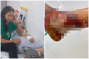 Người mẹ già nghèo khổ bất lực nhìn chân con trai đang bị hoại tử có khả năng phải cắt bỏ.
