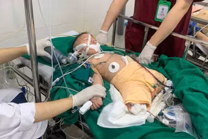 Tai nạn kinh hoàng đã cướp mất đôi chân khi vừa mới 2 tuổi.