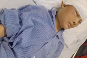 Trải qua 4 chu kỳ hóa trị và 30 mũi xạ trị toàn não khiến sức lực nam sinh ngày càng cạn kiệt.