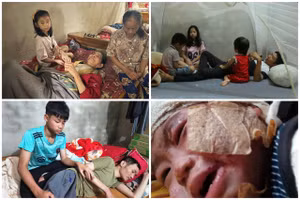 Các hoàn cảnh từ mã số MT33-MT36 được bạn đọc Báo GD&TĐ ủng hộ tổng số tiền hơn 65 triệu đồng.