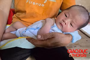 Danh sách bạn đọc ủng hộ bé Phước Sang