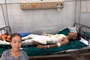 Người mẹ bất lực nhìn đứa con bị điện giật khiến toàn thân bị bỏng nặng. (Ảnh: GĐCC)