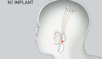 Tỷ phú Elon Musk công bố sắp cấy chip vào não người