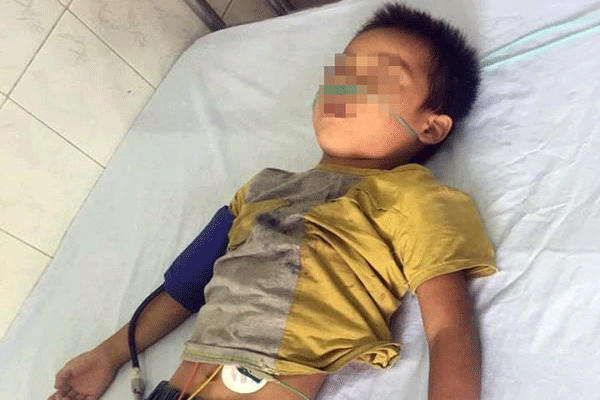 Bé 6 tuổi nguy kịch vì thói quen ăn uống nhiều cha mẹ mắc phải ảnh 1 Cậu bé 6 tuổi nguy kịch do ăn nhiều đồ ăn vặt