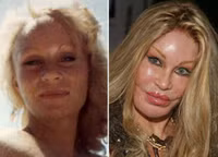 phẫu thuật thẩm mỹ