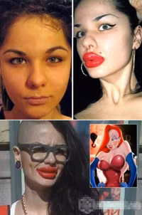 làm đẹp bằng dao kéo