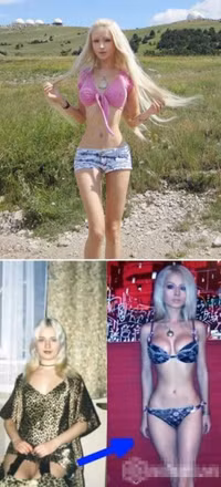 làm đẹp bằng phẫu thuật thẩm my