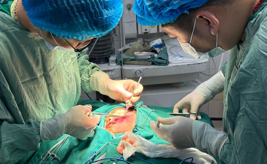 Bác sĩ tiến hành phẫu thuật cho bệnh nhi bị chó cắn. Ảnh: BVĐK tỉnh Tuyên Quang