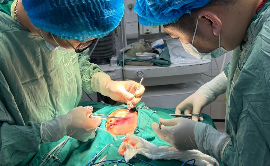 Bác sĩ tiến hành phẫu thuật cho bệnh nhi bị chó cắn. Ảnh: BVĐK tỉnh Tuyên Quang