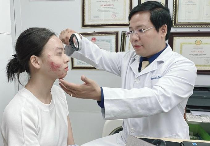 Bệnh nhân được chẩn đoán mụn trứng cá kèm viêm da tiếp xúc kích ứng nặng. Ảnh: Bác sĩ cung cấp