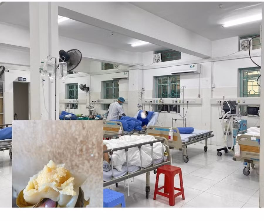 Sau cấp cứu, bệnh nhân vẫn rơi vào hôn mê sâu. Ảnh: BVCC