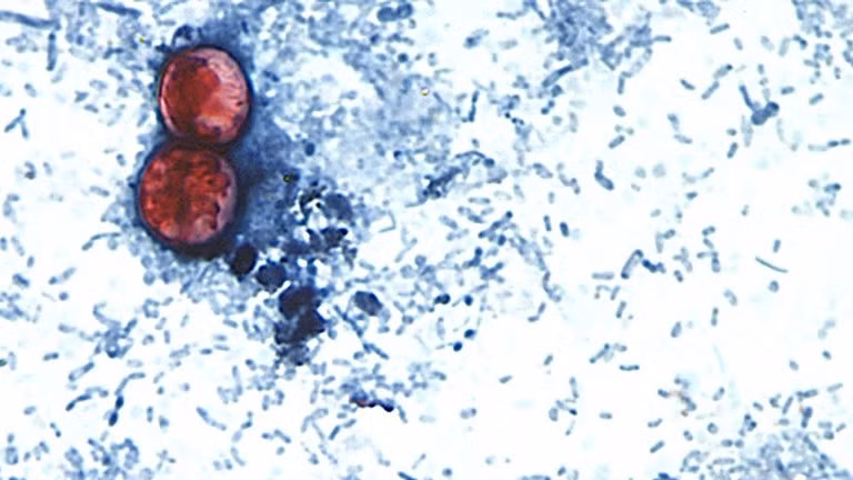 Hai nang bào tử Cyclospora cayetanensis.