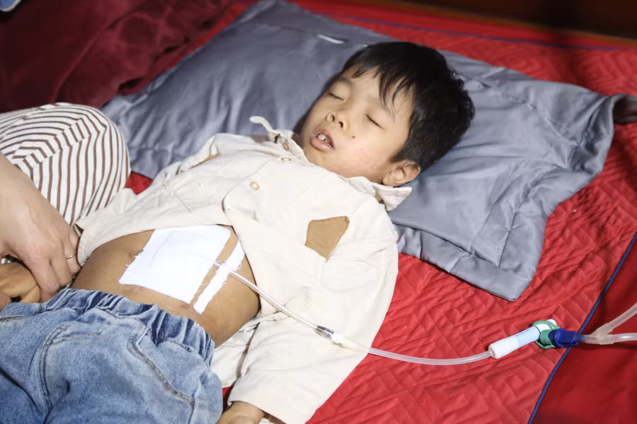 Cháu Bảo mỗi ngày phải chạy thận nhân tạo bằng phương pháp lọc màng bụng tại nhà.