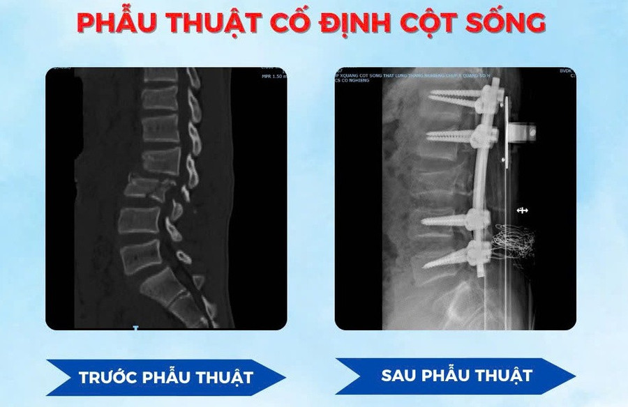 phau-thuat.jpg