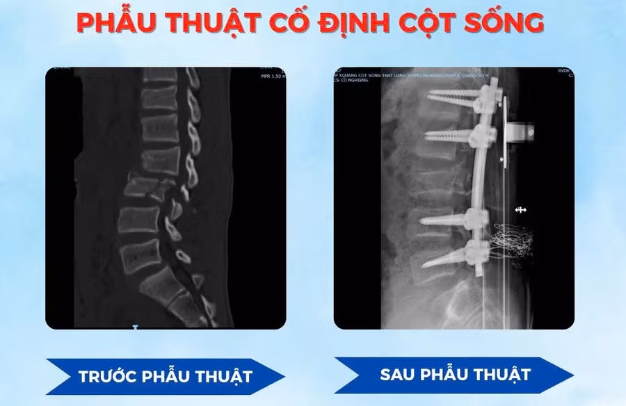 phau-thuat.jpg