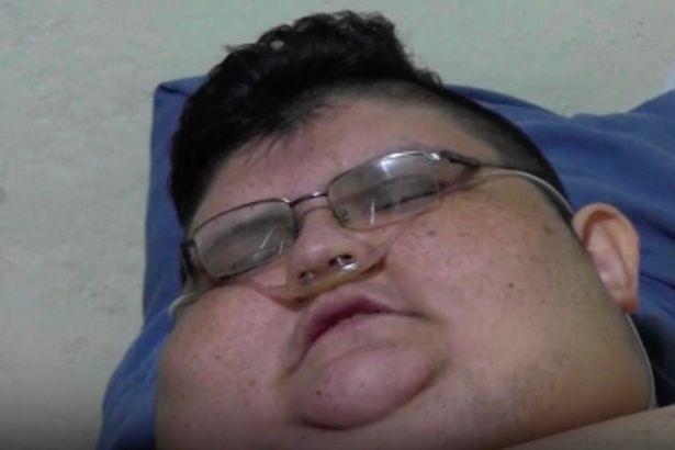 Juan phải thở máy để tránh ngừng thở giữa đêm