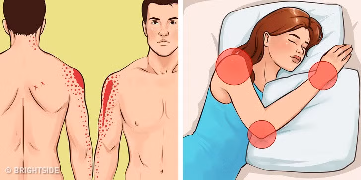 Nằm nghiêng khi ngủ rất dễ có nếp nhăn trên mặt, ngực chảy xệ, làm ngay một vài điều đơn giản này để khắc phục - Ảnh 2.