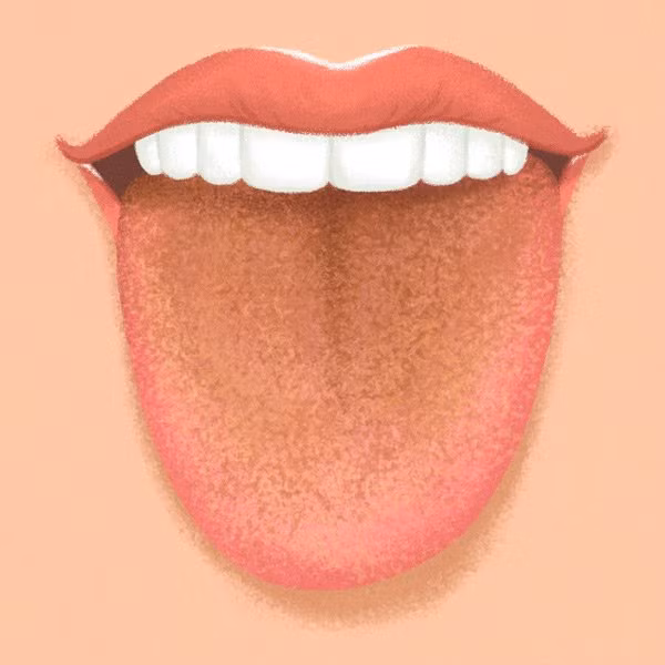 Bạn trai “rùng mình” từ chối hôn ngay khi mở miệng, cô gái xinh đẹp đi khám mới biết lý do ảnh 2 ban trai “rung minh” voi tu choi hon ngay khi mo mieng, co gai di kham moi biet ly do - 4