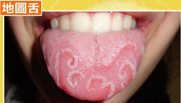 Bạn trai “rùng mình” từ chối hôn ngay khi mở miệng, cô gái xinh đẹp đi khám mới biết lý do ảnh 1 ban trai “rung minh” voi tu choi hon ngay khi mo mieng, co gai di kham moi biet ly do - 3