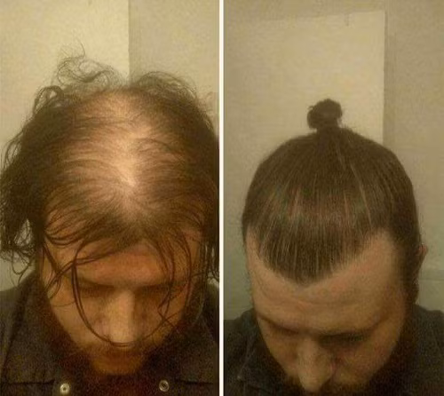 10-anh-hai-hot-nhat-facebook-trong-ngay-5