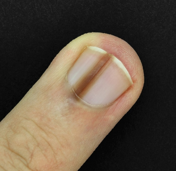10 dấu hiệu cảnh báo sức khỏe gặp nguy, ai cũng nên biết để bảo vệ mình ảnh 2 Không phải ai cũng biết 10 dấu hiệu cảnh báo sức khỏe gặp nguy để bảo vệ mình