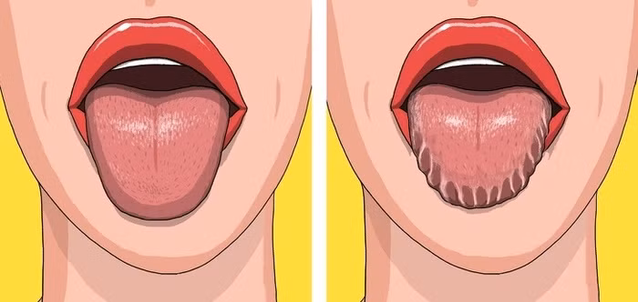 Không phải ai cũng biết 10 dấu hiệu cảnh báo sức khỏe gặp nguy để bảo vệ mình