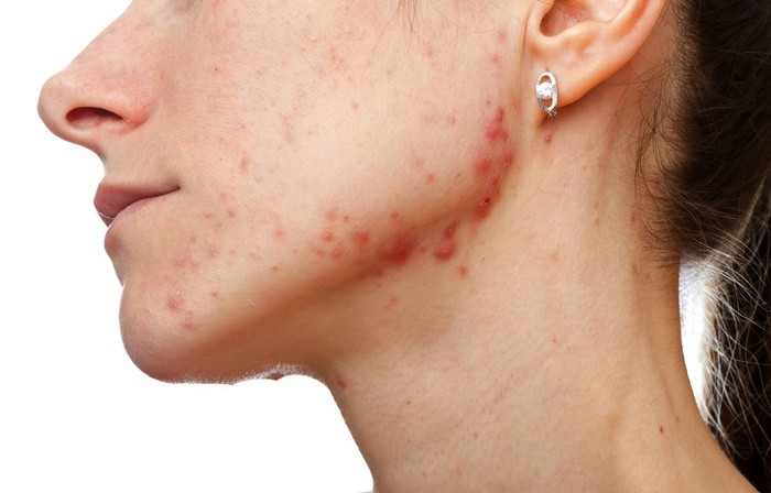 10 dấu hiệu cảnh báo sức khỏe gặp nguy, ai cũng nên biết để bảo vệ mình ảnh 4 Không phải ai cũng biết 10 dấu hiệu cảnh báo sức khỏe gặp nguy để bảo vệ mình