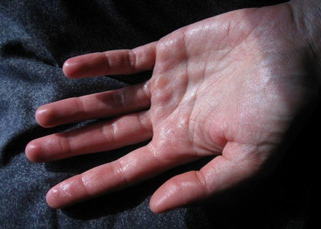 4 biểu hiện xuất hiện vào giữa đêm khi ngủ, đi khám gan ngay trước khi quá muộn ảnh 2 4 bieu hien xuat hien vao giua dem khi ngu, di kham gan ngay truoc khi qua muon - 3