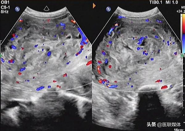 nguoi phu nu that ong dan trung nhieu nam nhung dot nhien thay “co thai”, di kham moi ngo ngang - 3