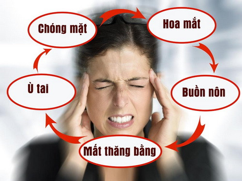 Dấu hiệu nhận biết hội chứng tiền đình