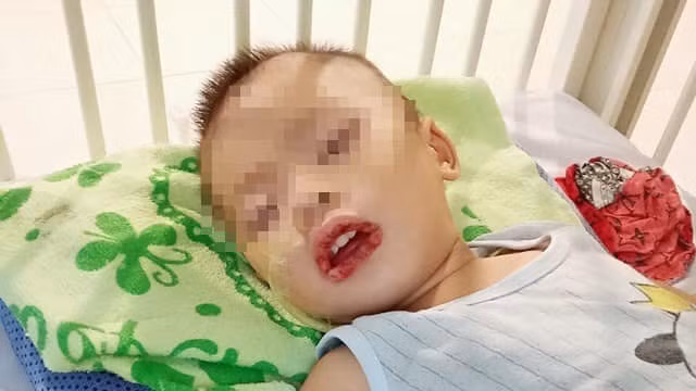 Phải để trẻ tránh xa các hóa chất.