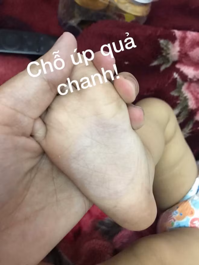 Các mẹ rầm rộ chia sẻ mẹo hạ sốt trị ho cho con bằng cách buộc chanh vào bàn chân, bác sĩ nói gì? - Ảnh 1.