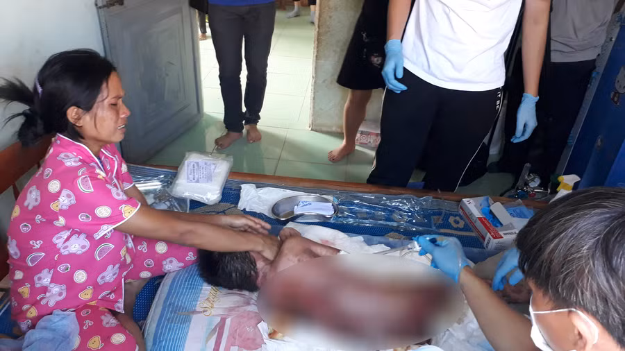 Chị I Hui cùng người con bị bỏng có nguy cơ nhiễm trùng máu nếu không được chữa trị.