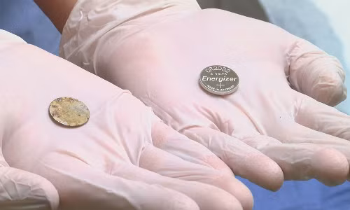 Làm sao để phòng ngừa tai nạn do pin cúc áo - 1