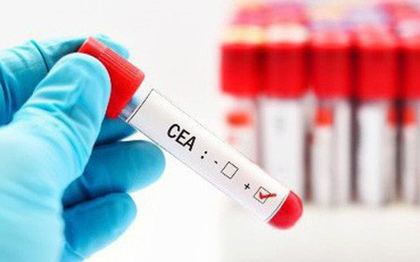  Các xét nghiệm máu quảng cáo phát hiện ung thư không có giá trị chẩn đoán 