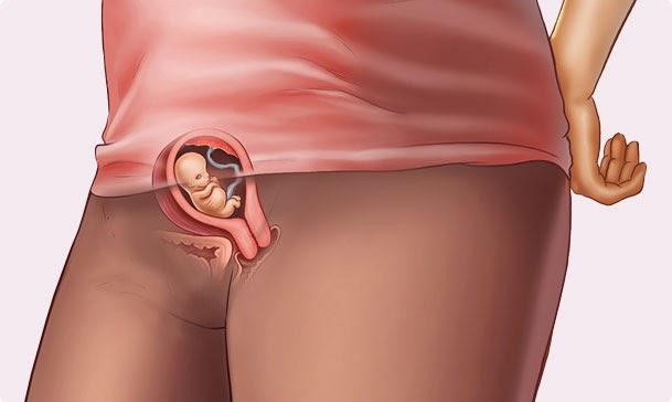 Có hay không dấu hiệu nhận biết có thai sau 7 ngày, hãy lắng nghe phân tích của chuyên gia ảnh 2 co hay khong dau hieu nhan biet co thai sau 7 ngay, hay lang nghe phan tich cua chuyen gia - 3