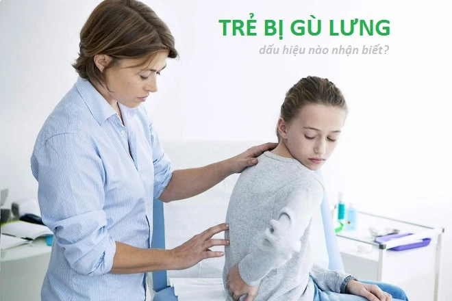 Trẻ bị gù lưng - nguyên nhân và dấu hiệu nhận biết