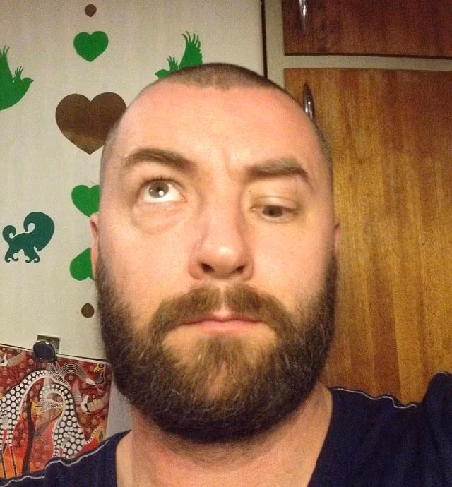 Khi những khiếm khuyết cơ thể trở nên đáng yêu hơn bao giờ hết - Hình 1