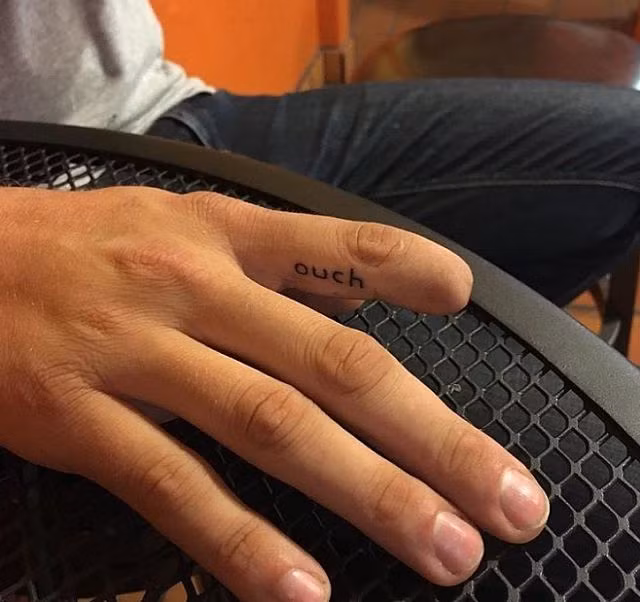 Khi những khiếm khuyết cơ thể trở nên đáng yêu hơn bao giờ hết - Hình 8