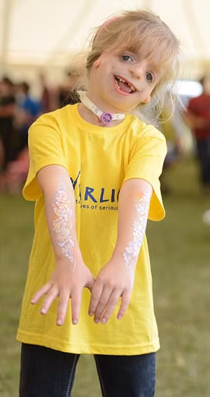 Dù mới 8 tuổi nhưng Maisie đã phải trải qua 29 cuộc phẫu thuật trên khuôn mặt