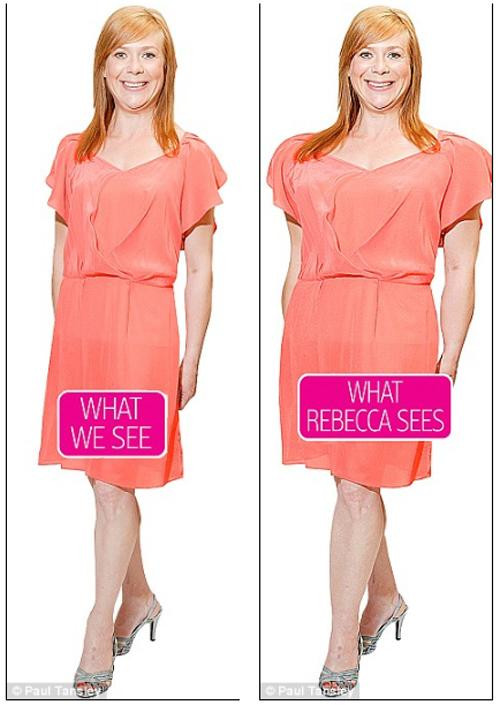 co gai tu nhan "xau het phan thien ha", suyt cat thit cho do beo nhung su that ngo ngang - 2