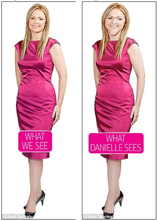 co gai tu nhan "xau het phan thien ha", suyt cat thit cho do beo nhung su that ngo ngang - 3