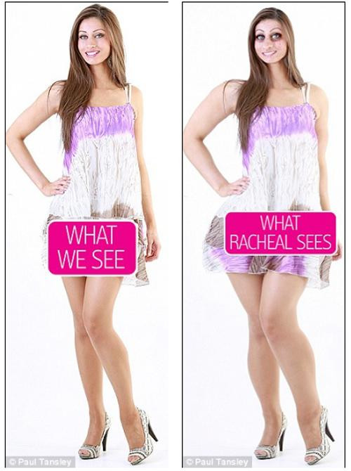 co gai tu nhan "xau het phan thien ha", suyt cat thit cho do beo nhung su that ngo ngang - 1